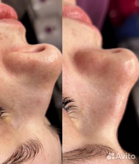 Массаж лица,расслабляющий массаж тела,чистка лица