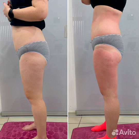 Модель на LPG