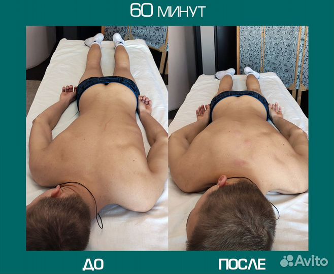 Костоправ. Массаж. Вправление