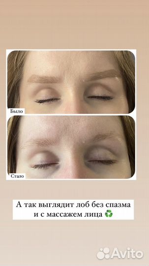 Массаж лица