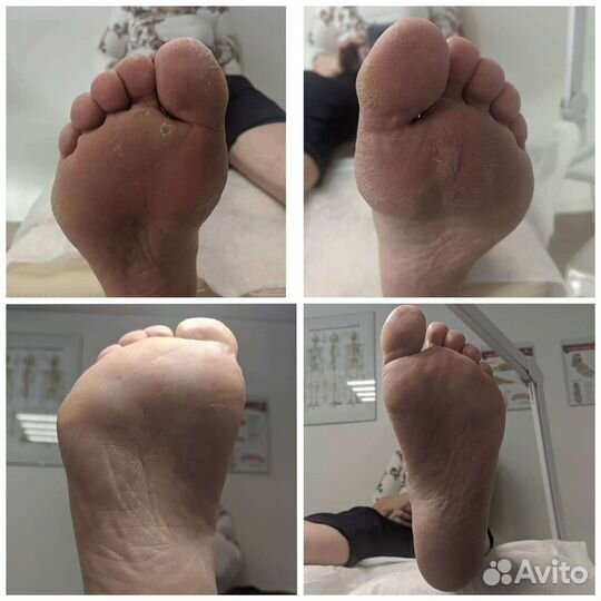 Подолог + мастер педикюра (лечебный и эстетический