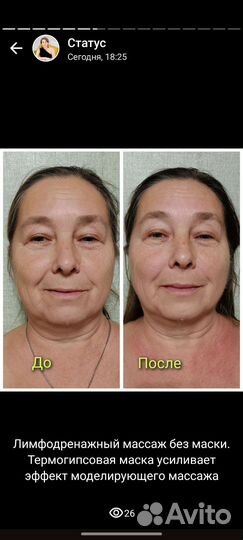 Модель на массаж лица (юмр)