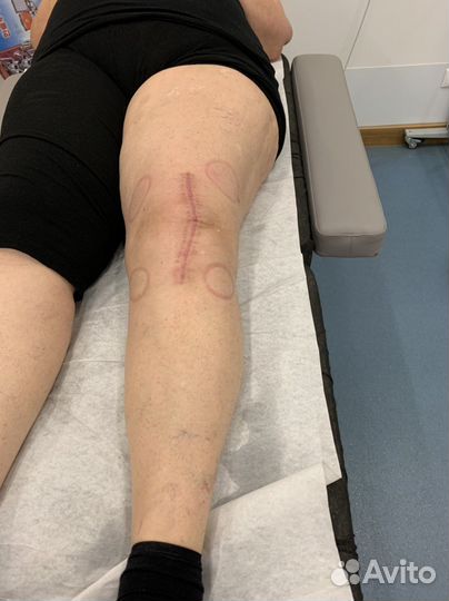 Реабилитация после травм и операций, массаж и лфк