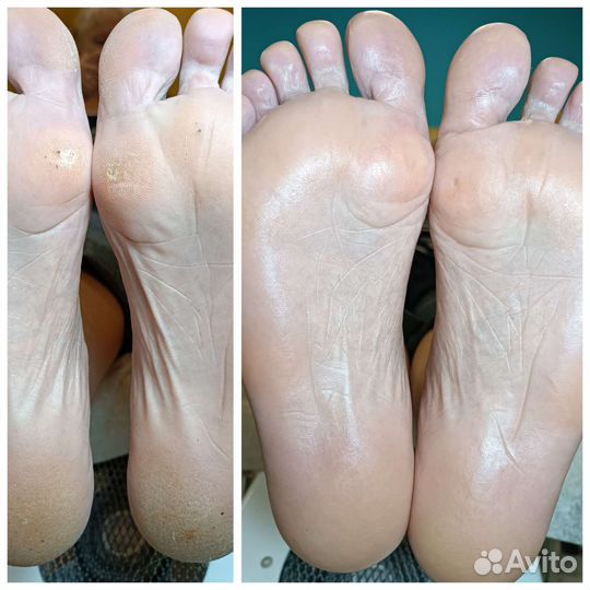 Маникюр и педикюр подолог