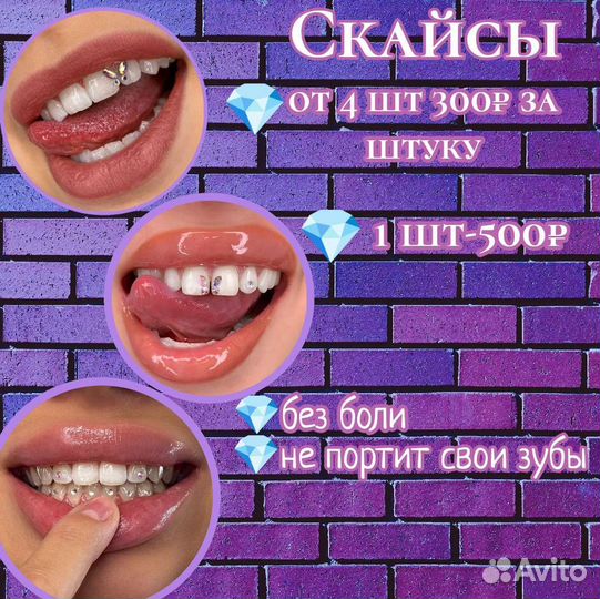 Скайсы, стразы на зубы