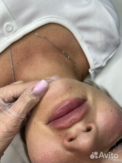 Увеличение губ