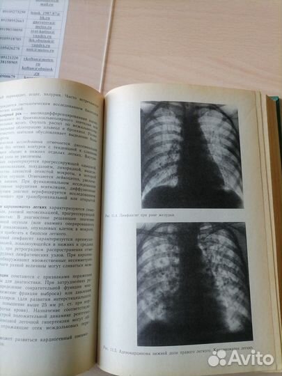 Диагностика и лечение внутренних болезней