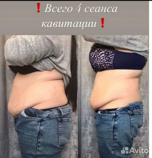 Массаж липолазер удаление жира в Перми