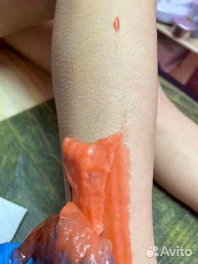 Депиляция