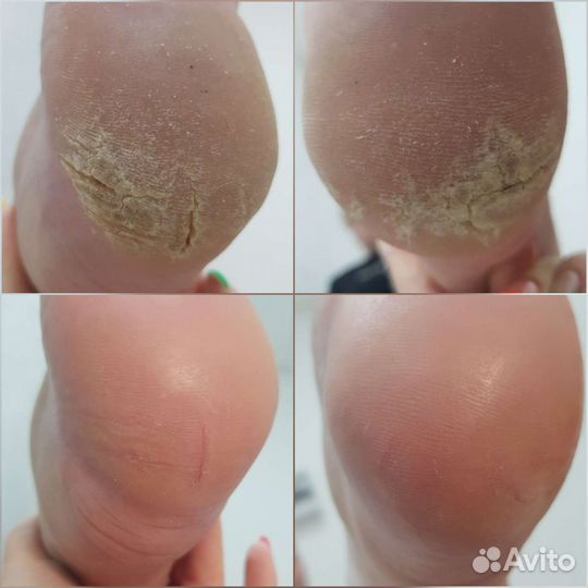 Мужской/женский педикюр