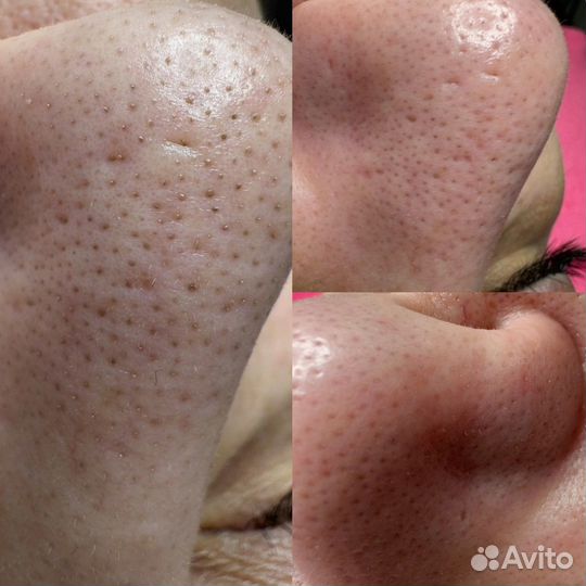 Коррекция фигуры, массаж,косметология