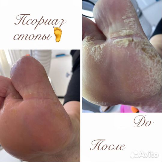 Подолог/ педикюр