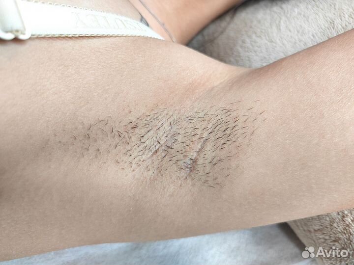 Восковая депиляция