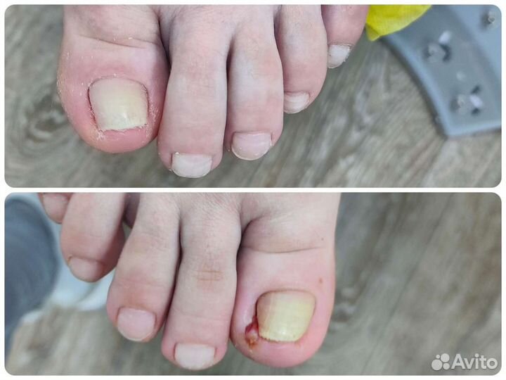 Подолог,педикюр