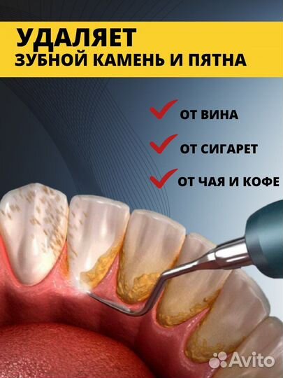 Ультразвуковой Скалер для чистки зубов