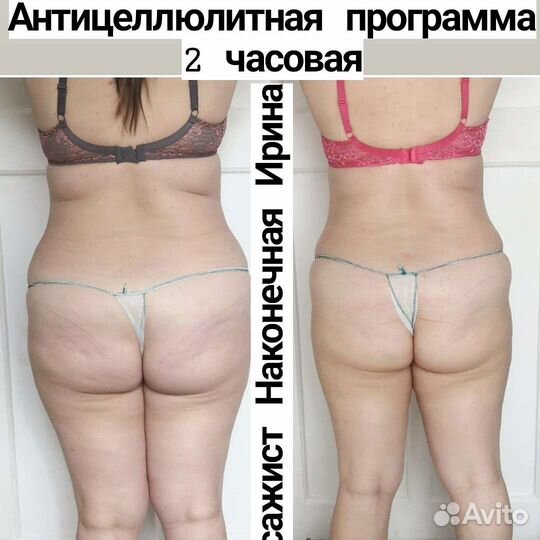 Массаж лечебный/Коррекция фигуры