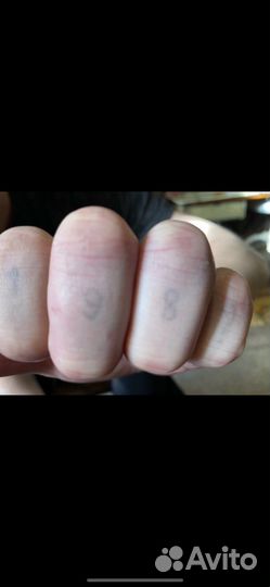 Удаление тату