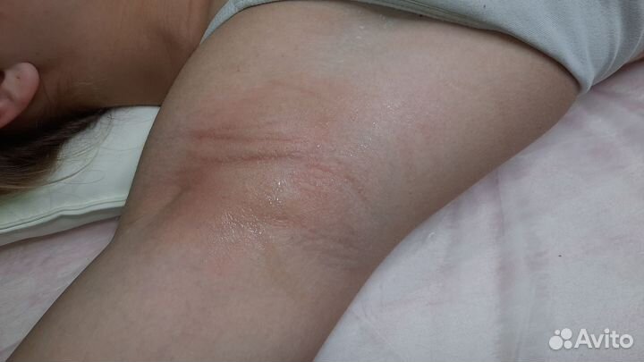 Шугаринг на дому