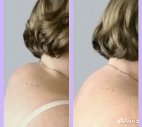 Модели на липолитики