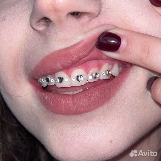 Скайсы / косметическое осветление зубов