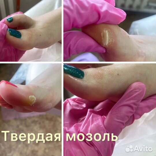 Подолог/ педикюр