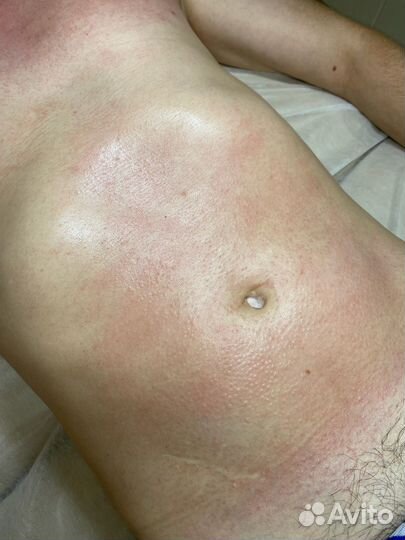 Мужская депиляция, по предоплате