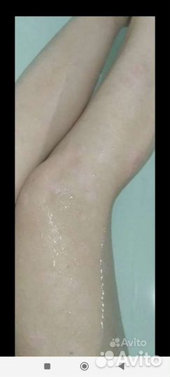 Мазь от псориаза