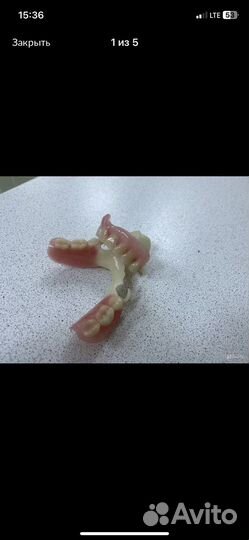 Зубные протезы