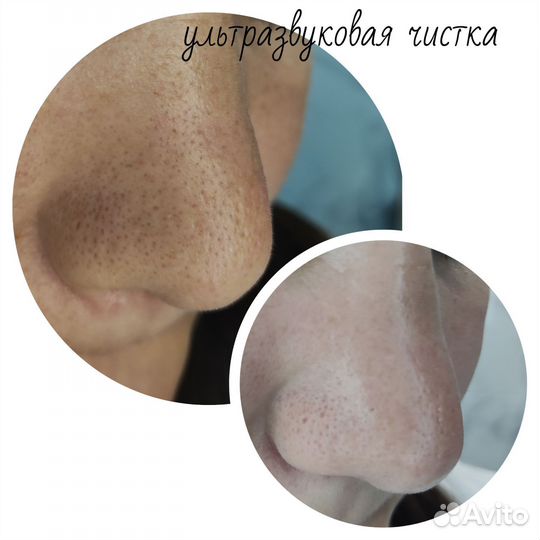 Услуги косметолога