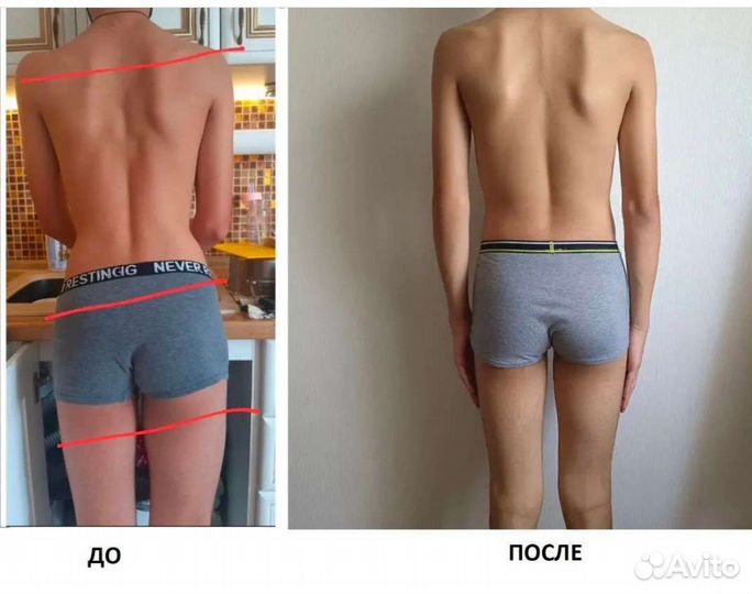 Косметология Массаж