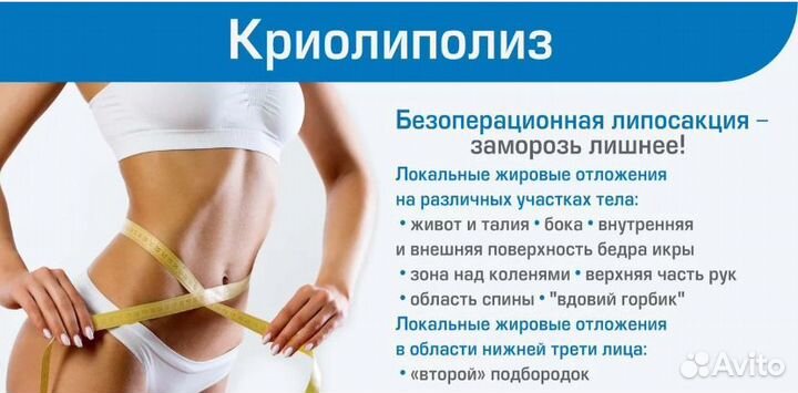 Криолиполиз, смас-липосакция