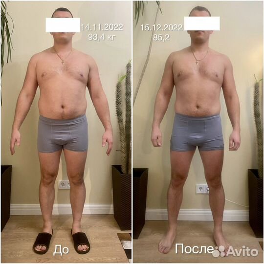 Безоперационная липосакция