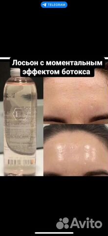 Лосьон