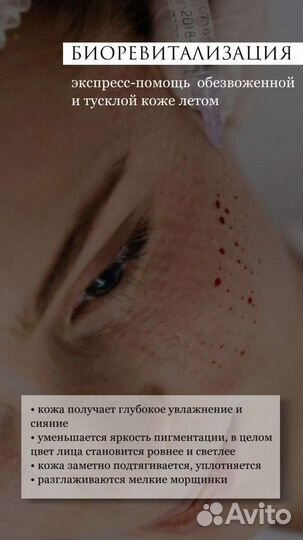 Биоревитализация
