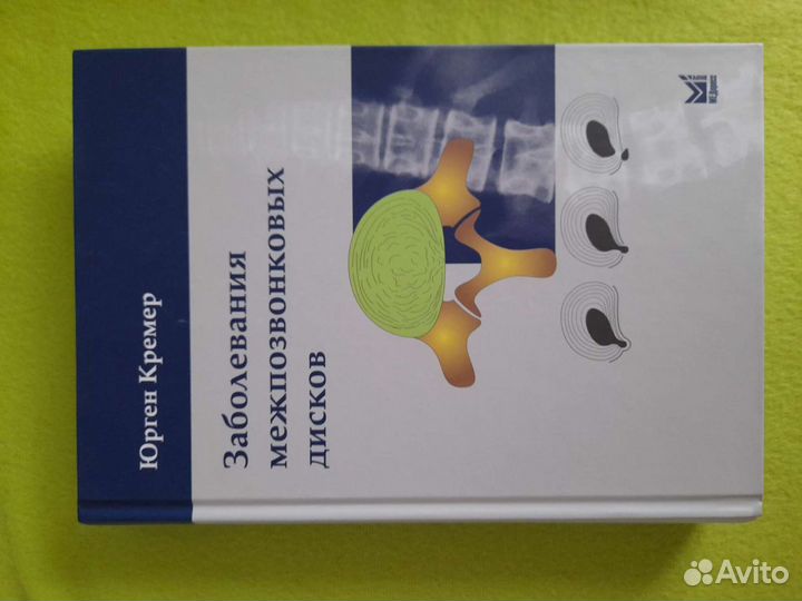 Книги по неврологии wolff's headache