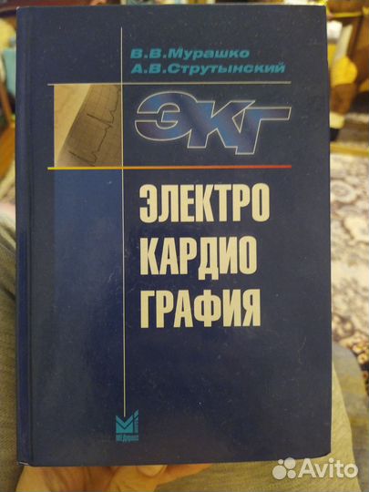 Электрокардиография экг