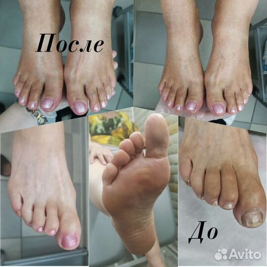 Педикюр, смарт педикюр