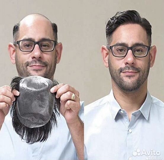 Мужская система замещения волос