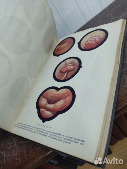 Урология. Профессор Г. Марион изд. 1931 год