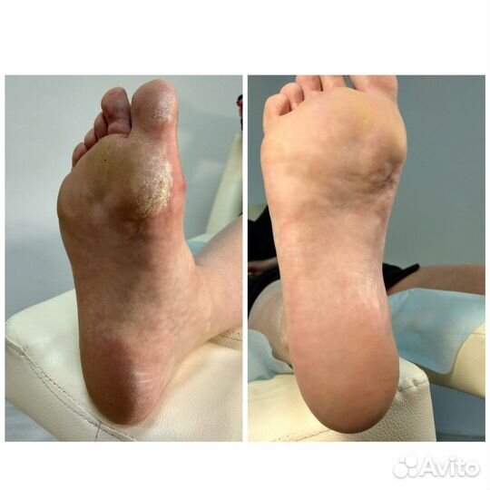 Педикюр- мастера Михаил/Светлана (Nail-студия)