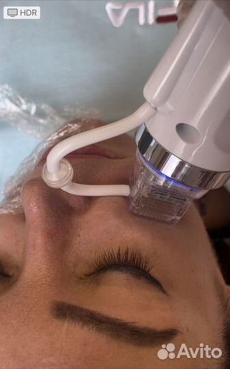 Микроигольчатый РФ лифтинг