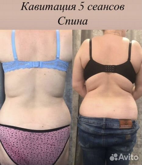 Аппаратная коррекция фигуры