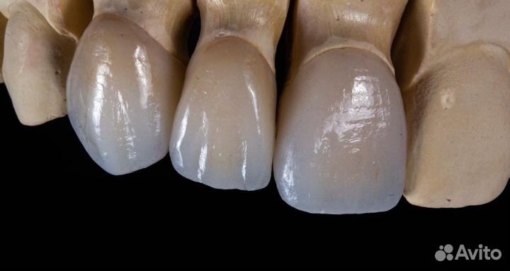 Зубной техник керамист