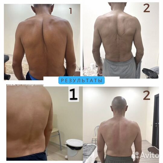 Массаж лечебный миофасциальный триггерный