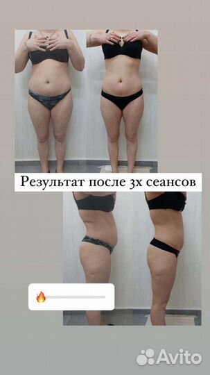 Массаж коррекционный, моментальный загар