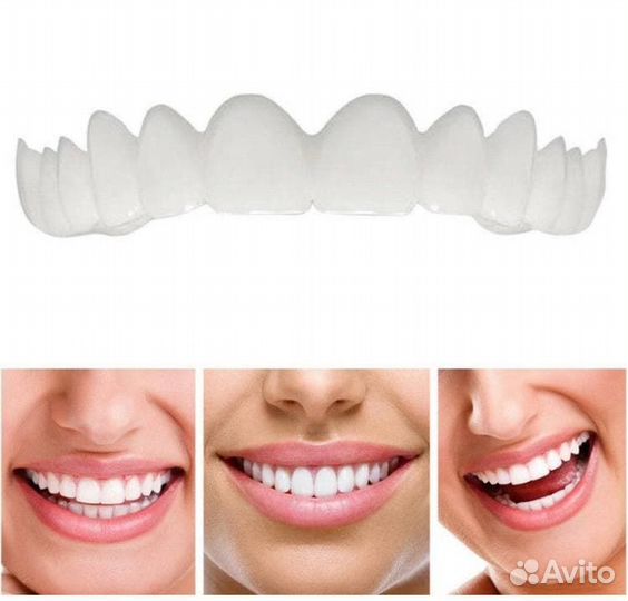 Виниры Snap-On TruSmile