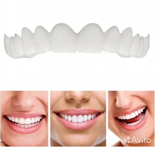 Виниры Snap-On TruSmile