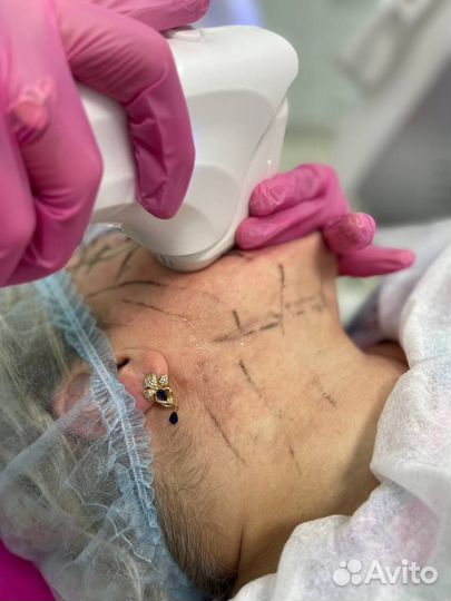 Оборудование для косметологии (все виды)