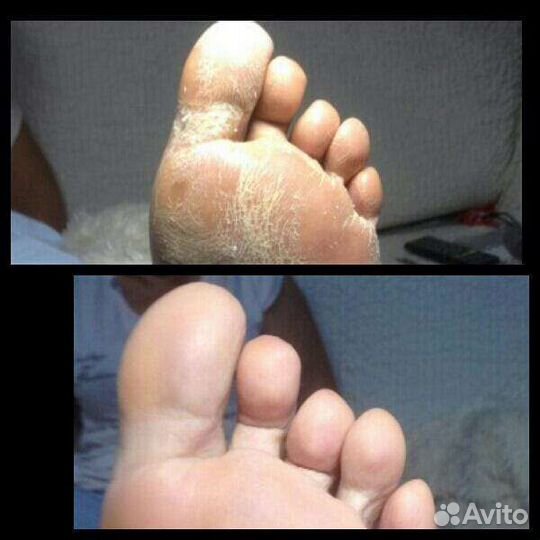 Мастер педикюра