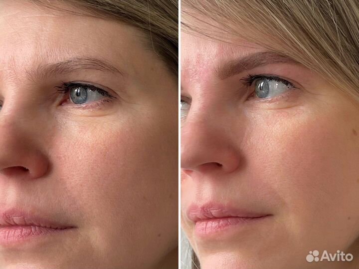 Брови и ресницы Ботаника